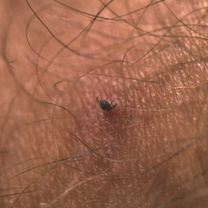 Zeckenentferner-Karte (kompakt) – Life Systems